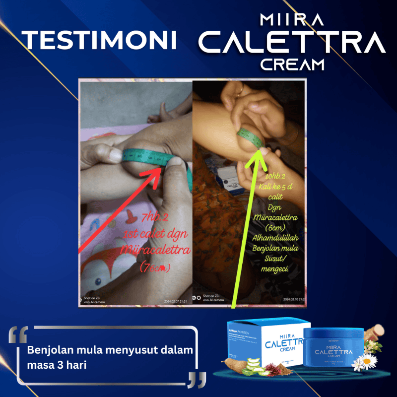 Testimoni caletra (1)