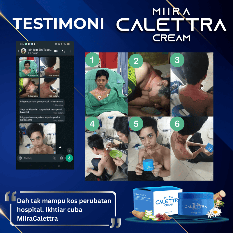 Testimoni caletra (2)