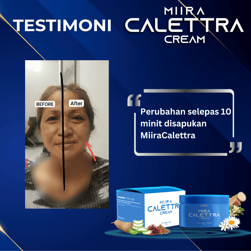 Testimoni caletra (3)